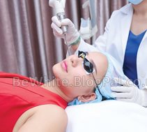 Bleaching face creams for Nigerian women