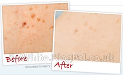What is the best whitening cream for Bangladeshi