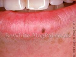 Whitening face creams for Malaysian woman