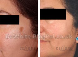 Skin product for Bangladeshi woman