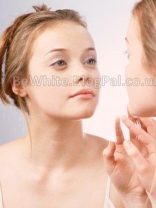 Pigmentation treatment for Indian woman