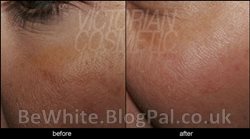 Effective whitening cream for Somalia