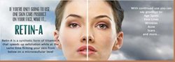 What is the best whitening cream for Malawian people