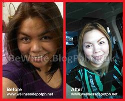 Top whitening creams for Black Trinidadians men