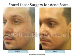 Skin lightening serum for Ghanaian woman