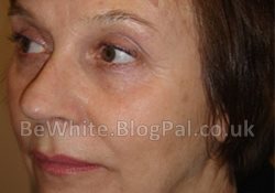 Facial whitening cream for Pakistani women