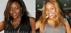 Bleaching skin products for face