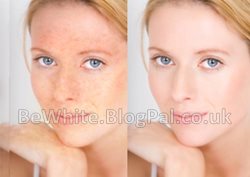 Skin whitening body cream for Somali men