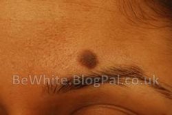 Uneven skin tone cream for South African men
