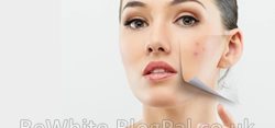 Bleaching your skin for Black Trinidadians