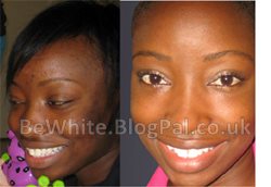 Whitening body cream for Zambian woman