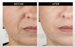 Skin bleach products for Jamaican woman