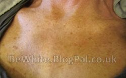 Skin whitening natural for Zambia men