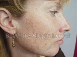 Best skin lightening products for Congolese