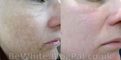 Asian skin whitening cream for Somali men