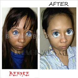 Lightening neck creams for Malawian