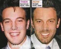 Whitening neck creams for Indian men
