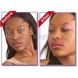 Body whitening products for Black Jamaican women
