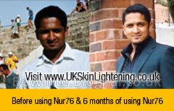 Bleaching black skin cream for Uganda woman