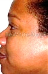Whitening bleaching cream for Jamaican people