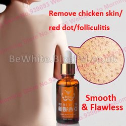 Best skin lightening product for Somalian people