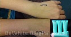 Skin lighteners for Congo