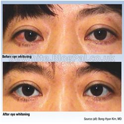 Skin whitening body cream for Somali people
