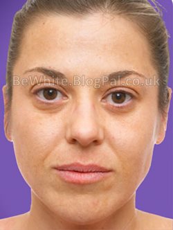 Skin lighteners for Zimbabwean woman