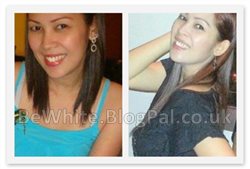 Uneven skin tone cream for Malaysian people