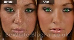 Effective whitening cream for Ghana women