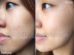 The best bleaching cream for black skin