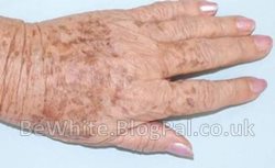 Bleaching body creams for Somalia woman