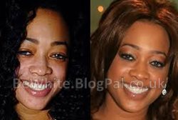 Bleaching dark skin creams for Pakistani