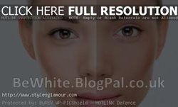 Body whitening for Trinidadians