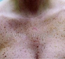 Lightening body creams for Zimbabwean people