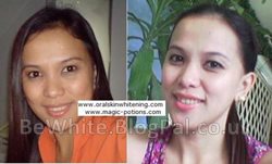 Bleaching body cream for Malawi men