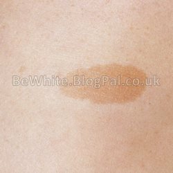 Whitening dark skin cream for Asian women