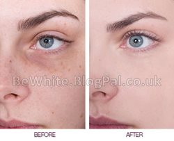 Kojic acid for Ghanaian woman