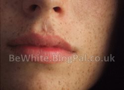 Bleaching neck creams for Black Africans woman