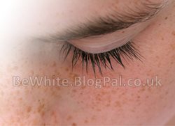 Kojic acid cream for Black Trinidadians people