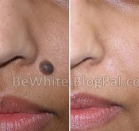 Best skin lightening creams for Zambia people