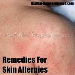 Best bleaching creams for Indian