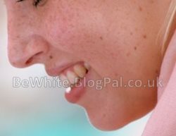 Whitening body for Zimbabwean woman