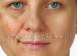 Skin care product for Ugandan people