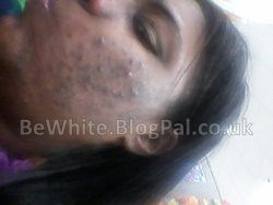 How to lighten dark skin for Zambian