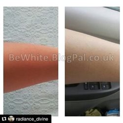 Best skin whitening creams for Malawian men