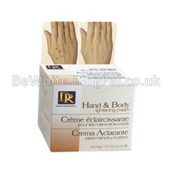 Acne cream for Jamaican woman