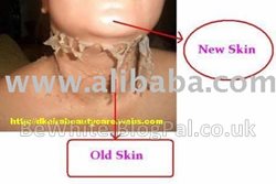 Best skin lightening product for Black Jamaican people