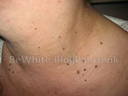 Best skin lightening product for Ghana men
