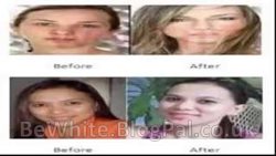 Body whitening products for Zimbabwean